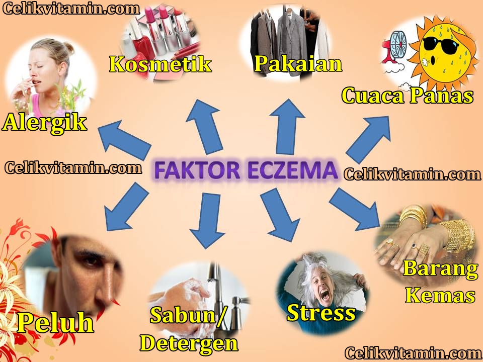 PENYAKIT ECZEMA